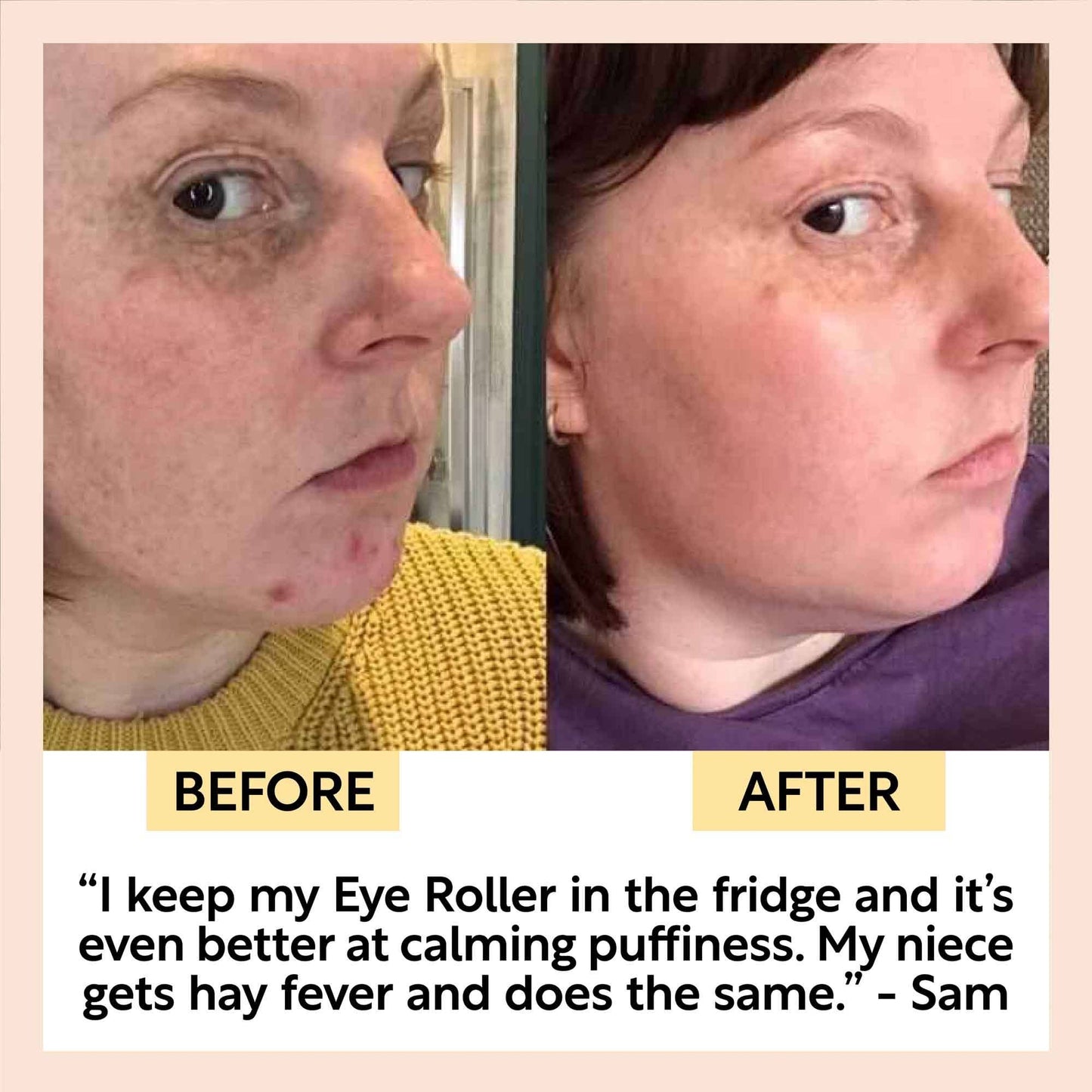 Eye Roller for Dark Circles & Puffy Eyes