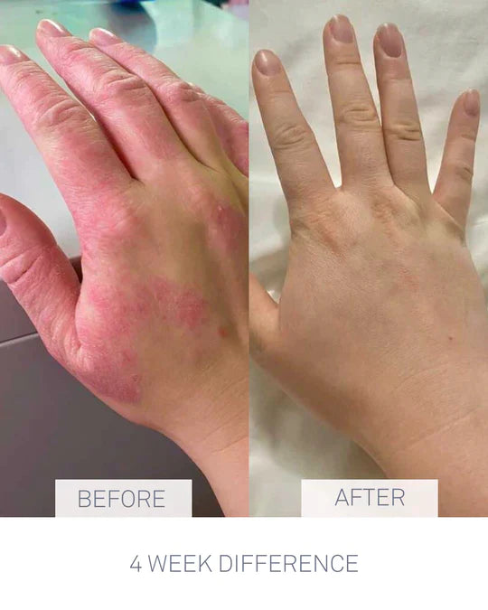 Caring Skin Fix